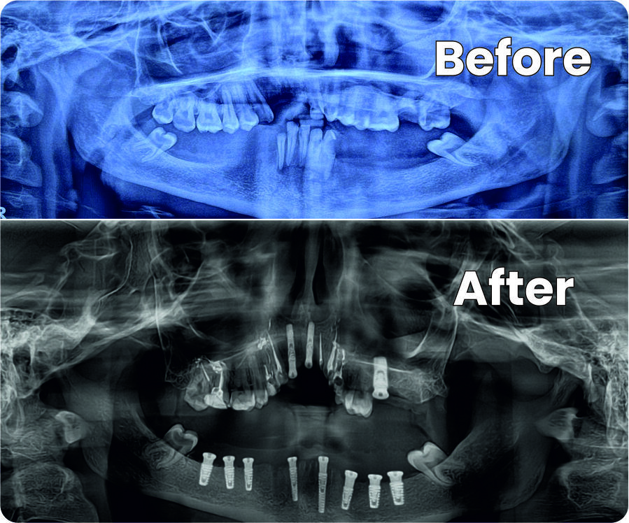 COMPLEX DENTAL SURGERY PERFORMED AT MAHANANDAN HOSPITAL