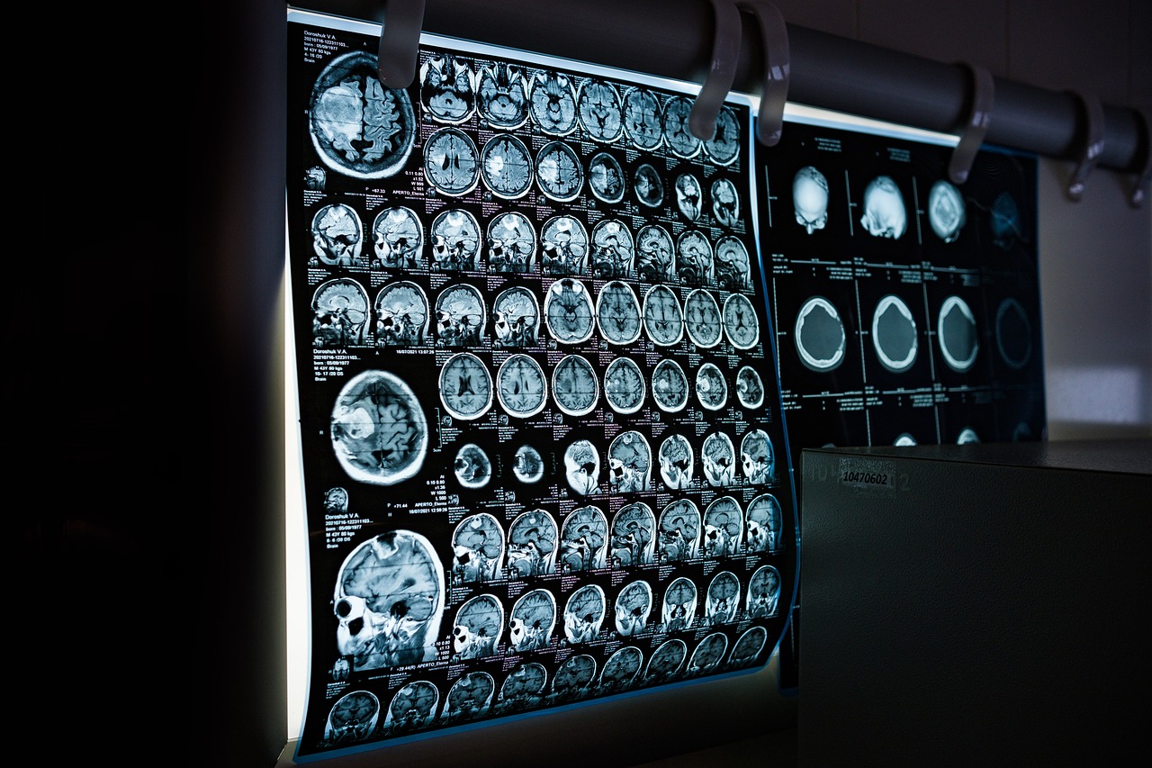 Understanding Neurology: A Comprehensive Guide to Brain and Nervous System Health